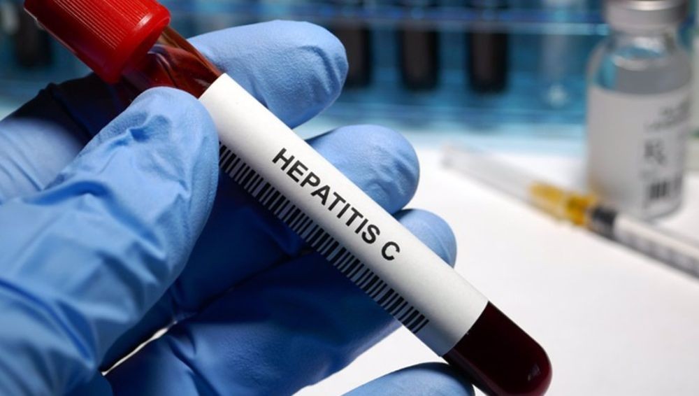 Lanzan campaña que busca pacientes con hepatitis C para curarlos 